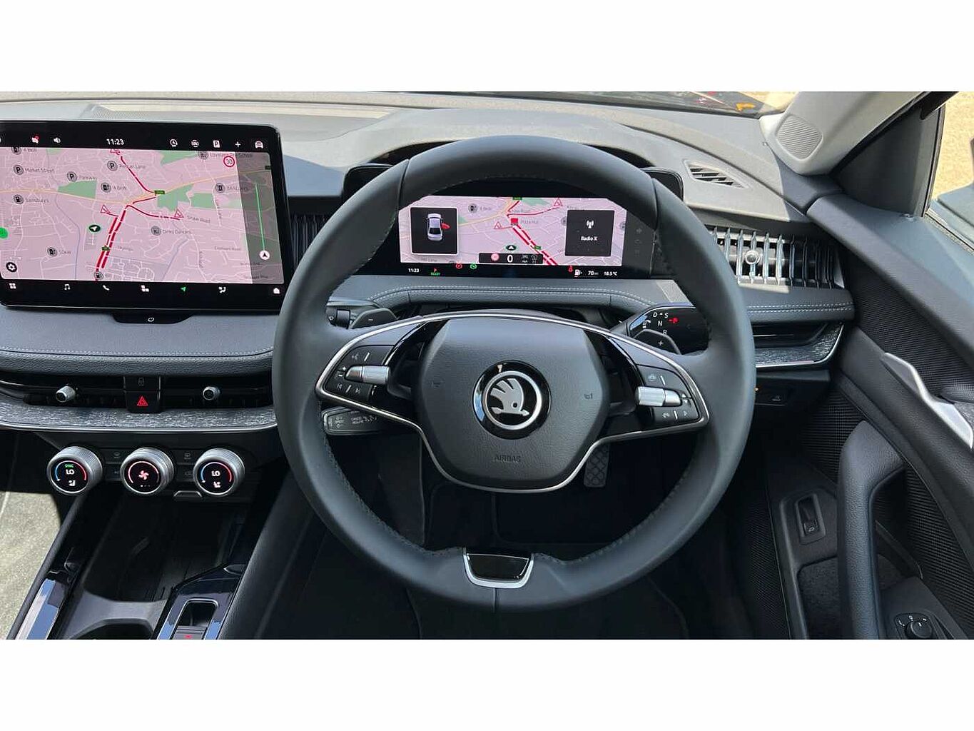 SKODA SUPERB Hatch SE L 1.5 TSI e-TEC 150 PS DSG
